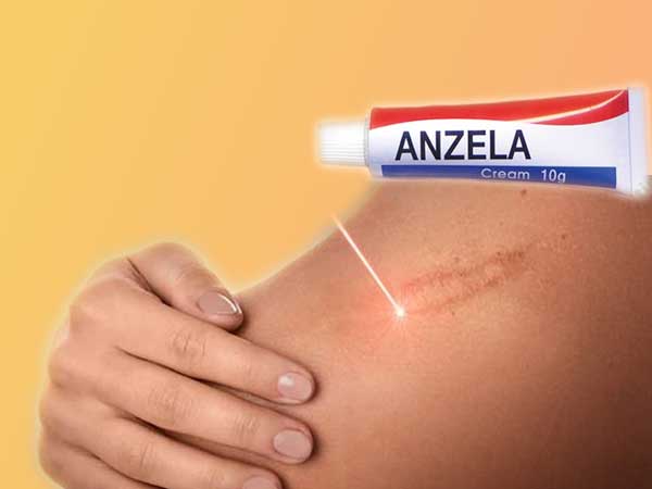 Anzela C là sản phẩm được nhiều người tin dùng lựa chọn